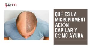 micropigmentación capilar