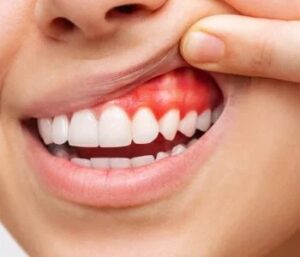 Estética dental