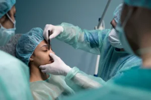 rhinoplasty Toronto