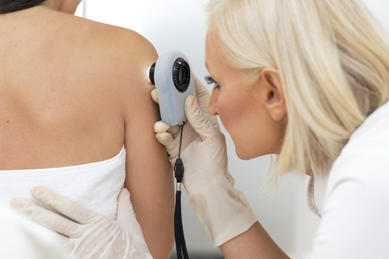skin check
