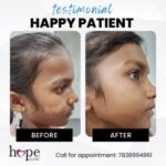 hope-clinic-dr-parth-thakkar-vesu-surat-dermatologists-4ayj52plit-250