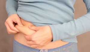 Liposuction In Dubai