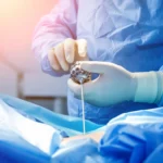 endoscopic-spine-surgery2-1024x1024