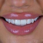 images - 2026-09-17T103024.993